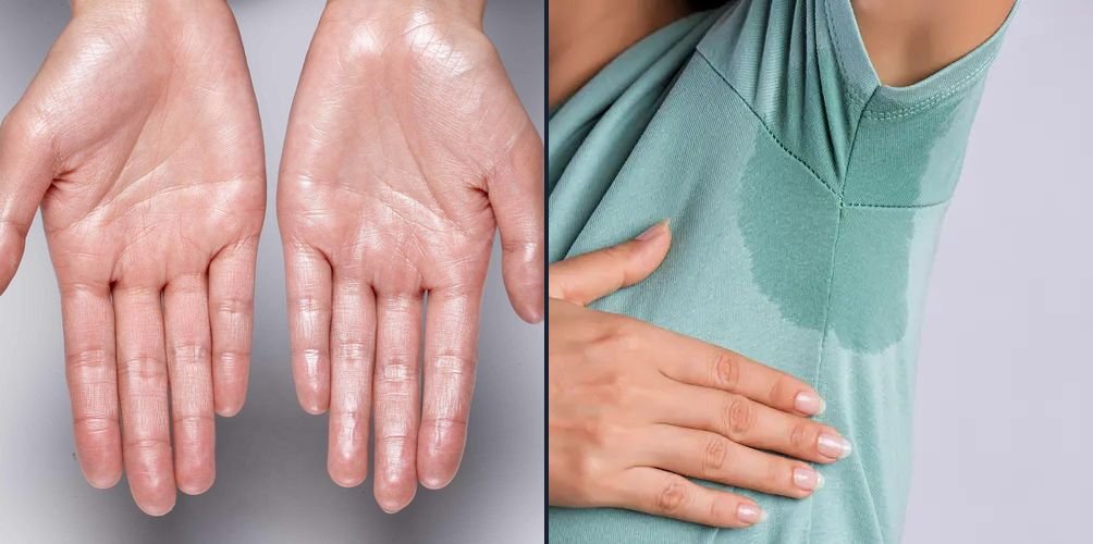 Mãos molhadas de suor ao lado de uma camisa marcada de suor na axila